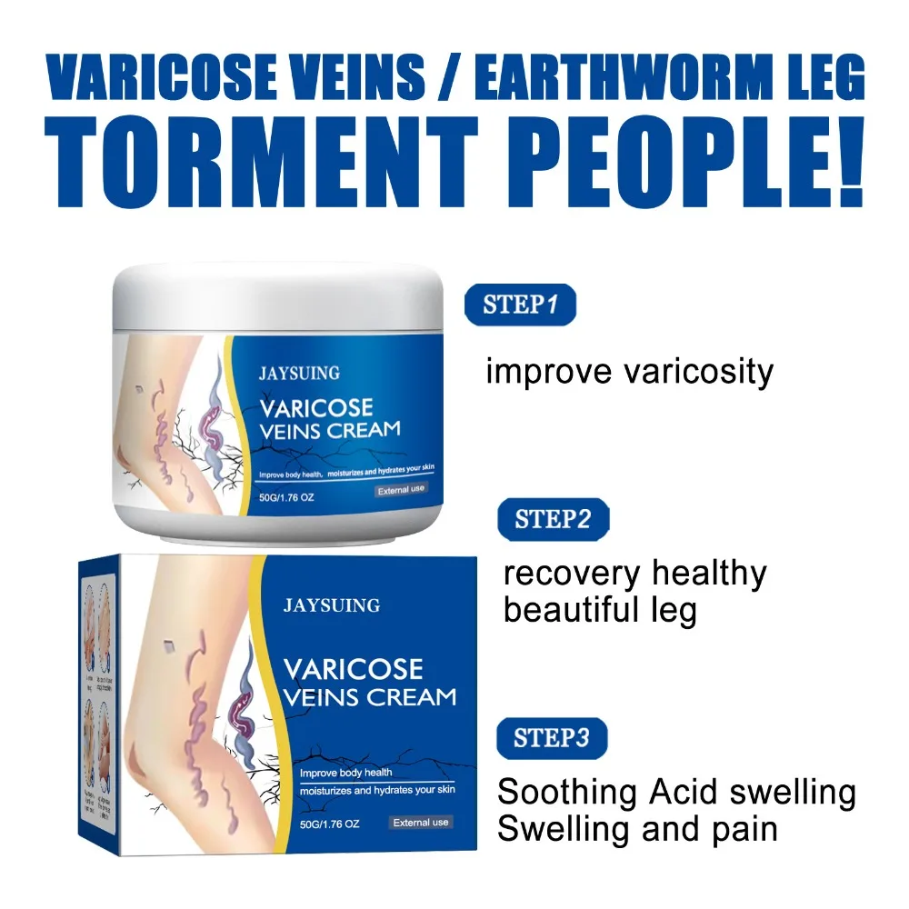 50g/1.76fl.oz Legs Varicose Veins Treatment Pain Relief Mild & Safe Legs Skin Cream Moisturizes The Skin