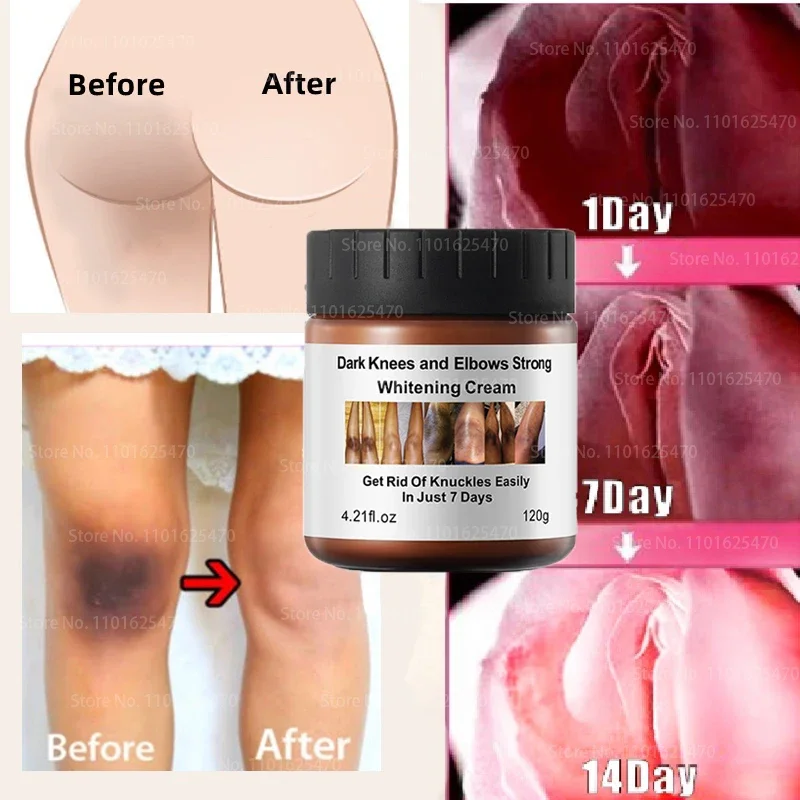 

Body Whitening Cream Private Parts Underarm Bleaching Serum Whiten Butt Knee Brighten Inner Thigh Intimate Dark Remove Melanin