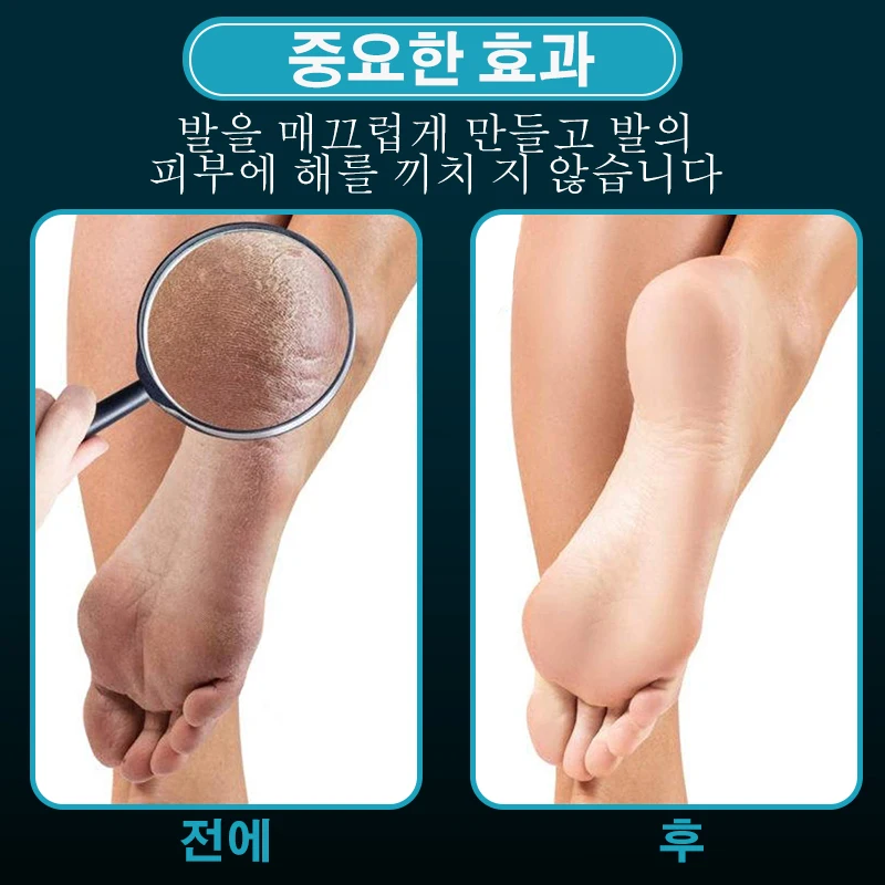 유리 풋 파일 네일 버퍼 세트 2 개, 캘러스 리무버 힐 데드 스킨 케어 제거 전문 매니큐어 페디큐어 도구 드롭쉬핑