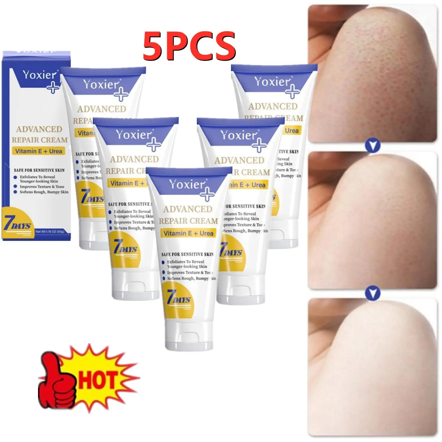 5PCS 7Days Moisturizing BodyCream Treatment Keratosis Pilaris Improves E Bumpy Rough Whitening Texture Skin Softens Vitamin Tone