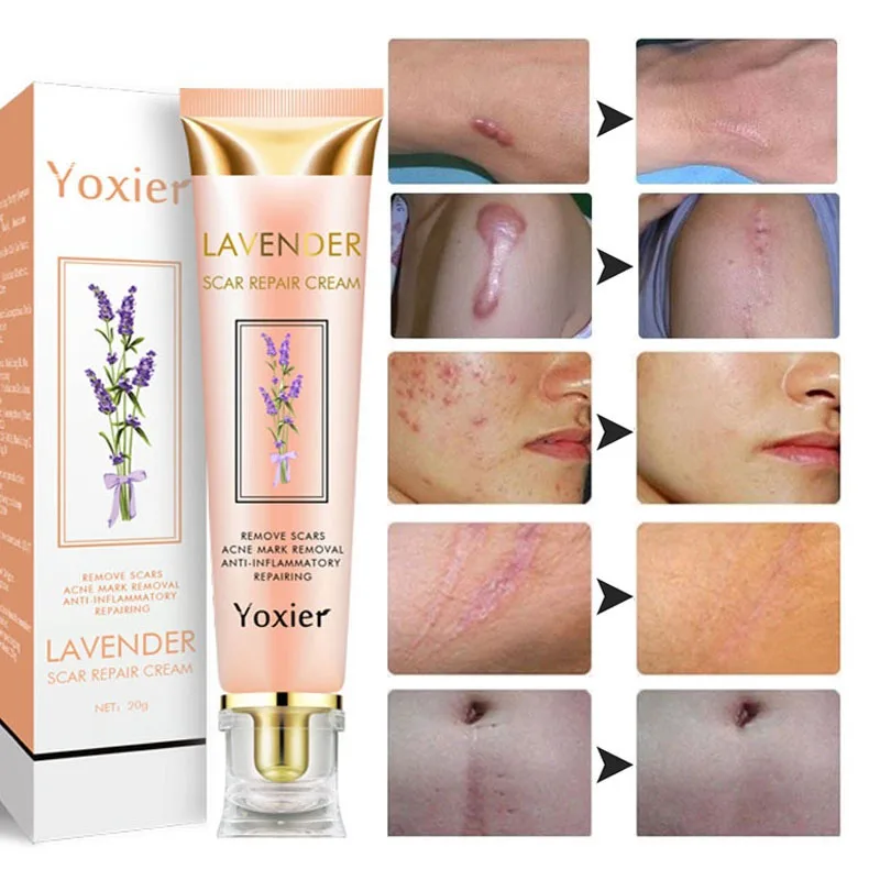 20g Scar Repair Cream Removal Burn Scars Promote Cell Regeneration Acne