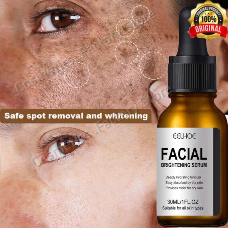 Dark Spots Remover Whitening Serum Face Freckle Melanin Correcting Anti Pigmentation Brighten Skin Beauty Care Products facial serum,facial essence,whitening serum,retinol face serum,salicylic acid facial serum
