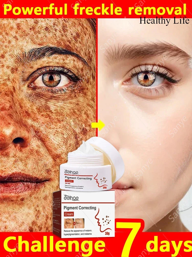 

Face Dark Skin Brightening Cream Women Moisturizing Remove Melasma Cream Removal Chloasma Lighten Cream Fade Dull Brighten Care