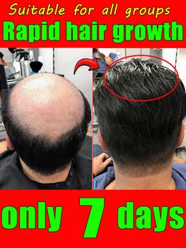 Double hair growth essential oil, the result of plant essence research, say goodbye to baldness and hair loss, without harming t