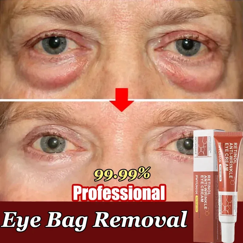 

Retinol Anti-wrinkle Eye Cream Remove Eye Bags Dark Circles Fade Fine Lines Anti-Aging Puffiness Lift Firming Whitening Eye Care