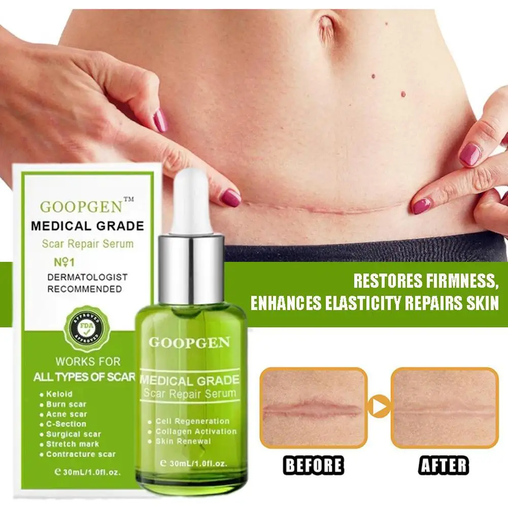 

Skin Scar Removal Cream Face Fade Scars Cream Moisturizing Repair Skin Whiten Anti-Aging Anti-wrinkle Cream Scar Stretch Marks
