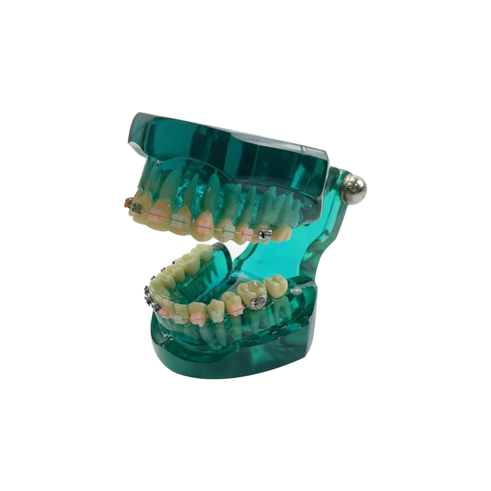 치과 교정 모형 타이포돈트 반금속 반세라믹 교정 치아 모형 학습 교육 환자 교육용