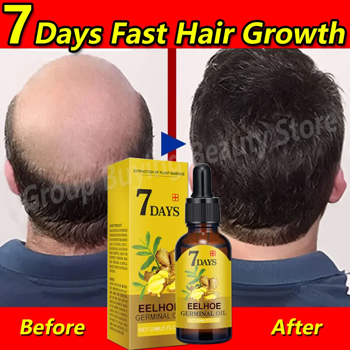 7 Days Fast Ginger Hair Growth Serum Anti-Loss Hair Regrowth Treatment Essential Oil Repair Damaged Hair Roots Nourish Hair Care