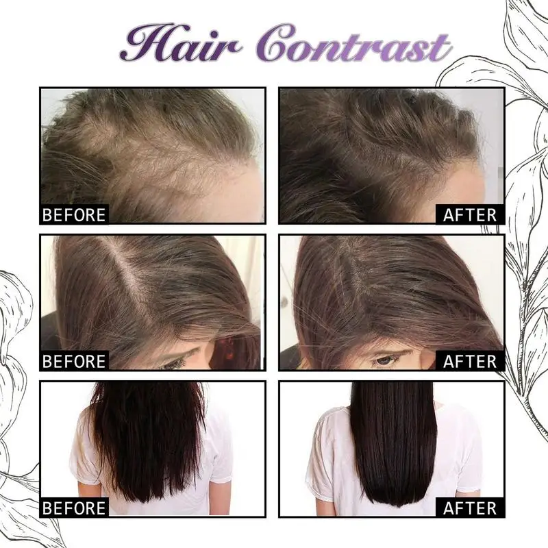 30 مللي رذاذ نمو الشعر البصل إكليل الجبل كثيفة مكا...