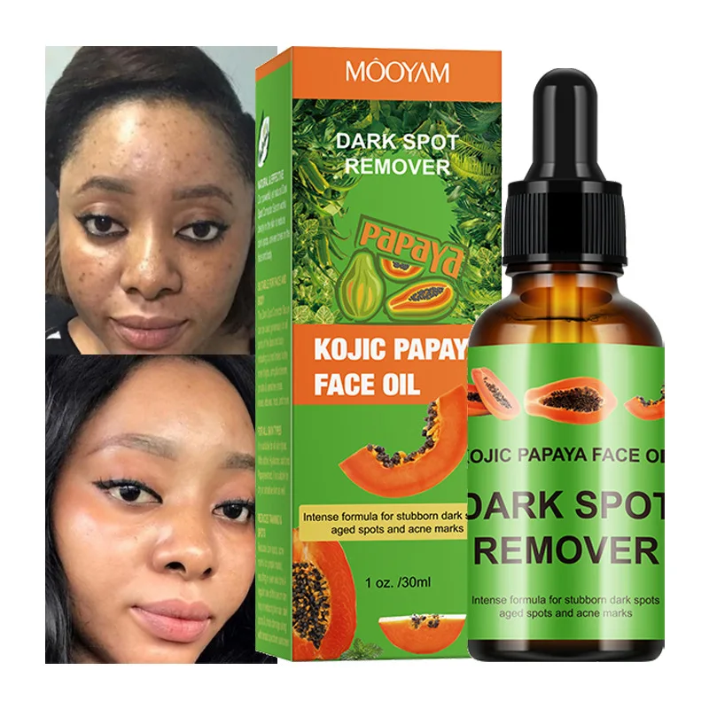 Cross border cosmetics papaya kojic acid essence nourishes skin care lightens black spots brightens kojic acid papaya essence