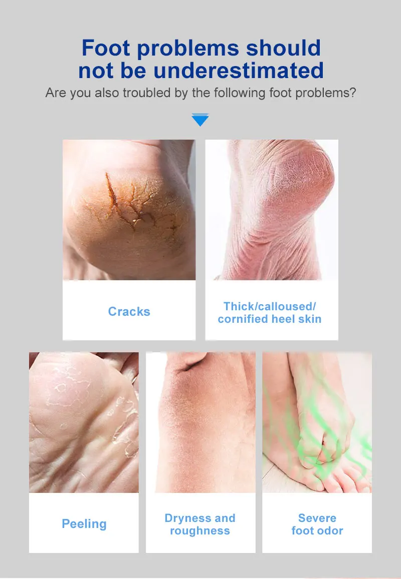 Description Picture 3 of itemUrea Foot Cream Moisturizing Exfoliating Hand Feet Dead Skin Removal Anti Peeling Heels Repair Mask Foot Skin Care Products