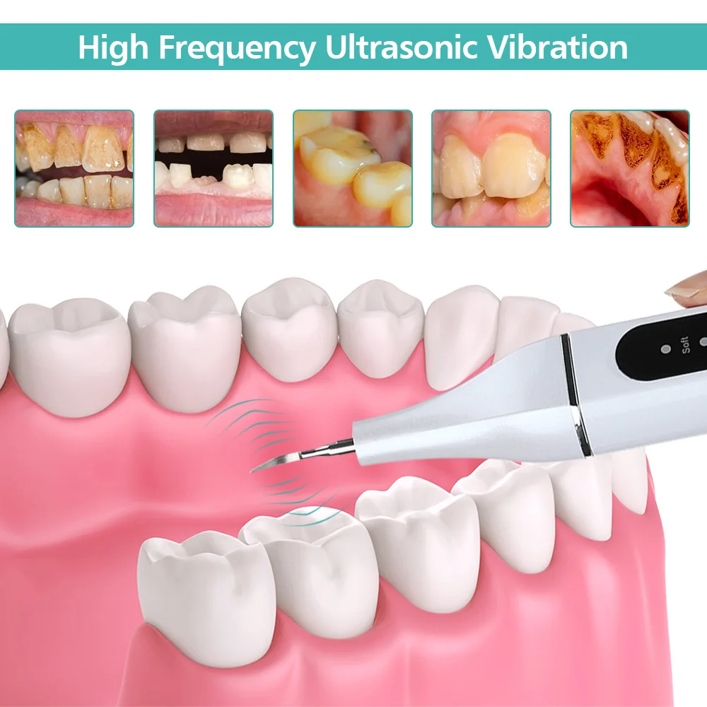 Description Picture 5 of itemWhitening Oral Hygiene Tools Dental Scaler Ultrasonic Tartar Scraper Calculus Remover Electric Cordless Stains Cleaner Home