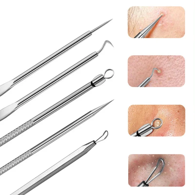 German No. 5 Cell Pimples Blackhead Clip Tweezers Beauty Face Health Salon Special Blackhead Remover Acne Needle Tool