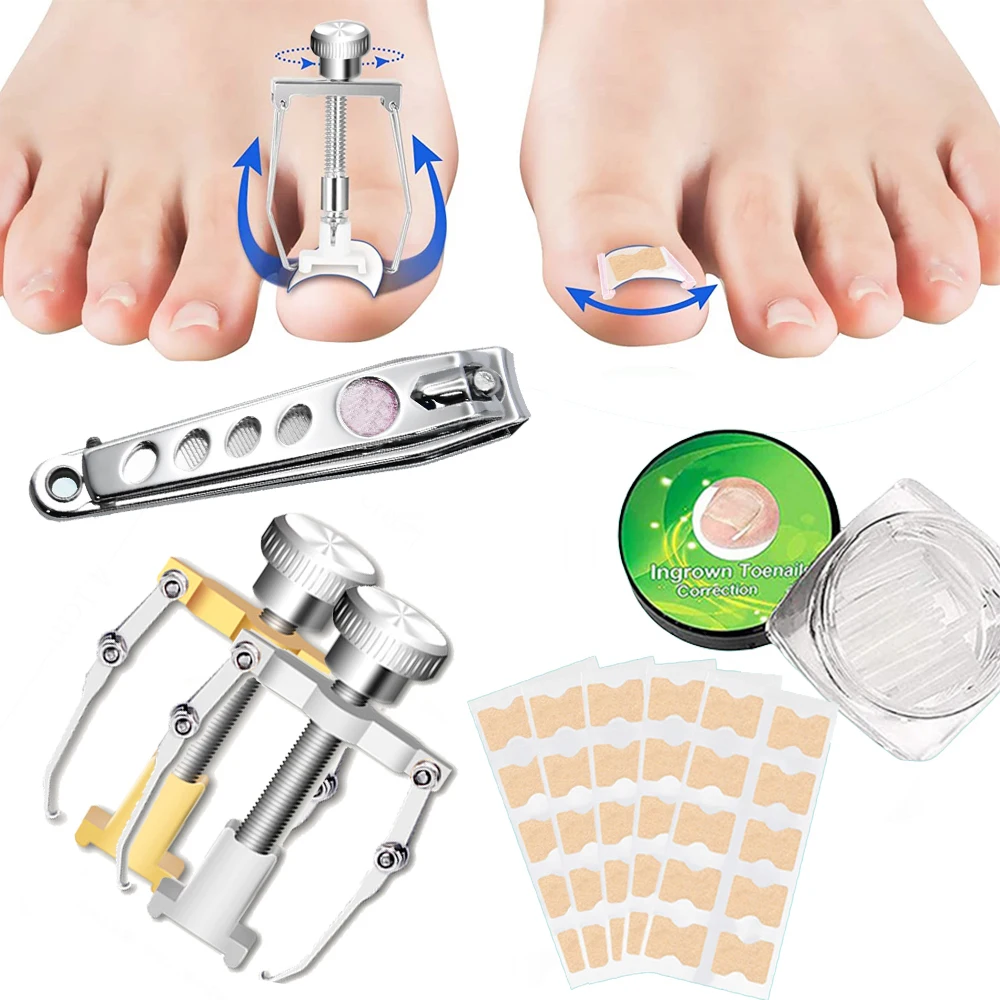 Toenail Corrector Ingrown Nail Pad Flexible Ortho Nail Filling Nail
