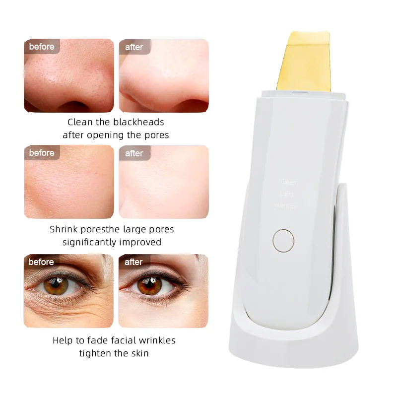 EMS Ultrasonic Skin Scrubber Vibration Face Spatula Blackhead Remover Shovel Clean Cavitation Peeling Facial Lifting Machine