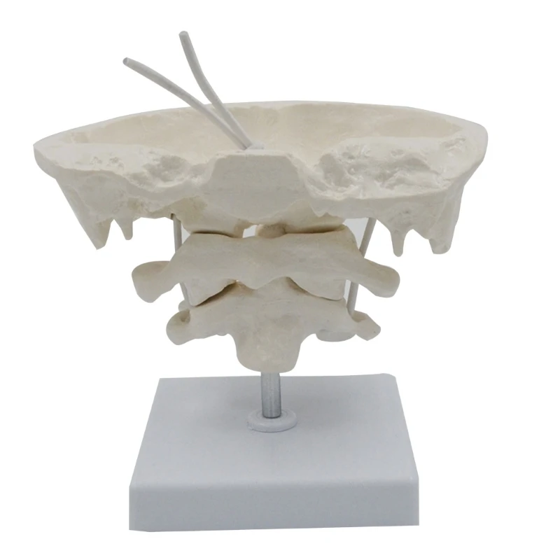 

Occipital Bone Model Educational Model Occiput Model for Medical Teaching New Dropship