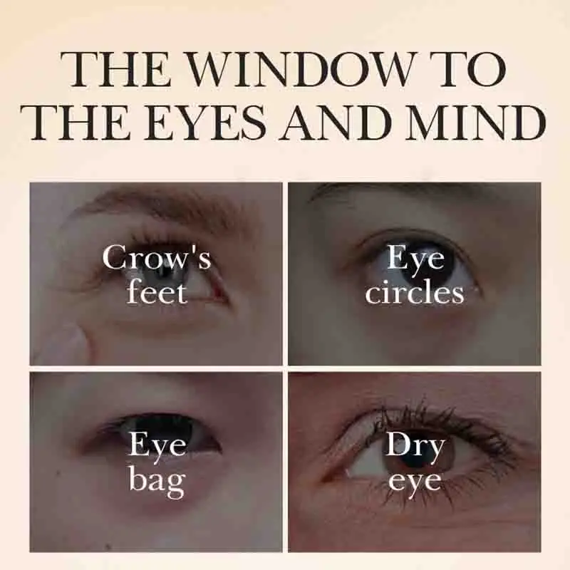 SADOER Caviar Eye Cream Anti Dark Circles Removal Eye Bags Anti-aging Anti Wrinkles Moisturizing Eyes Skin Care Proudcts