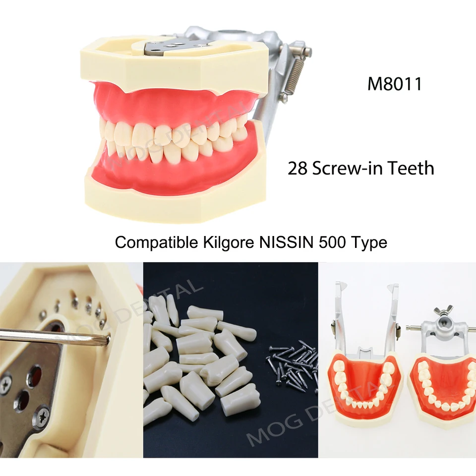 Typodont Dentaire Avec Dents à Visser - Compatible Kilgore NISSIN 200/500