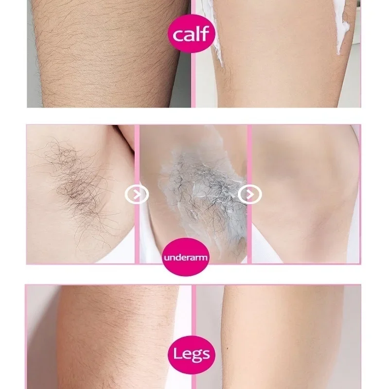 2 Minutes Fast Hair Removal Spray Painless Hair Growth Inhibitor Leg Arm Armpit Permanent Depilatory for Ladies Men Repair Care hair removal spray,hair growth removal inhibitor