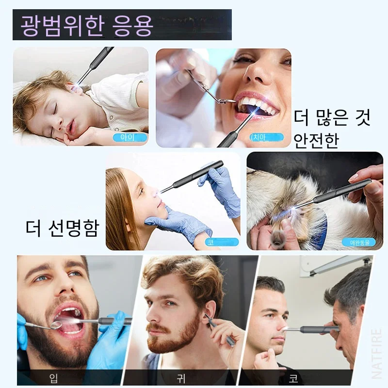 NATFIRE NP20 스마트 귀 클리너 검이경 귀 왁스 제거 도구, 카메라 포함, 귀 내시경 1080P 키트, 아이폰 아이패드 안드로이드용