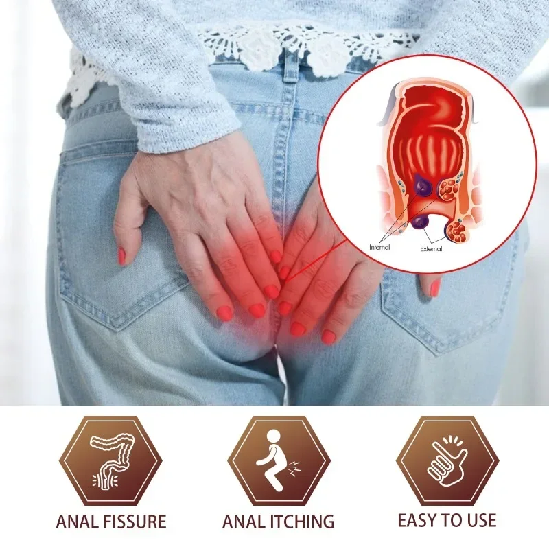 1Pcs Herbal Hemorrhoid Ointment Treat Butt Anal Fissure Pain Swell Repair Cream Internal External Hemorrhoids Eliminates Care