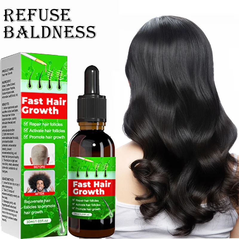 

Fast Hair Growth Promoter Products Hair Loss Hereditary Seborrheic Alopecia Treatment Oil For Hair Growth Essence Natural Safety