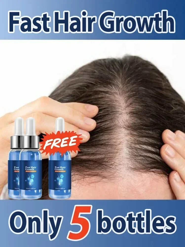 

ᴴᵃⁱʳ ᵍʳᵒʷᵗʰ ᵉˢˢᵉⁿᵗⁱᵃˡ ᵒⁱˡ⸴ ᵉᶠᶠᵉᶜᵗⁱᵛᵉˡʸ ʳᵉᵖᵃⁱʳˢ ᵇᵃˡᵈⁿᵉˢˢ⸴ ʰᵃⁱʳ ˡᵒˢˢ⸴ ᵃⁿᵈ ᵖʳᵉᵛᵉⁿᵗˢ ʰᵃⁱʳ ˡᵒˢˢ