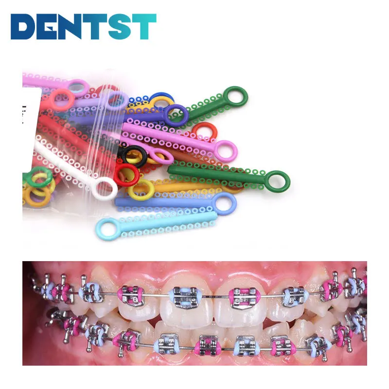 

Dentst 40Pcs/Pack Dental Elastomeric Ligature Ties Orthodontics Elastic Rubber Bands Braces Ligadura Ortodoncia Materail