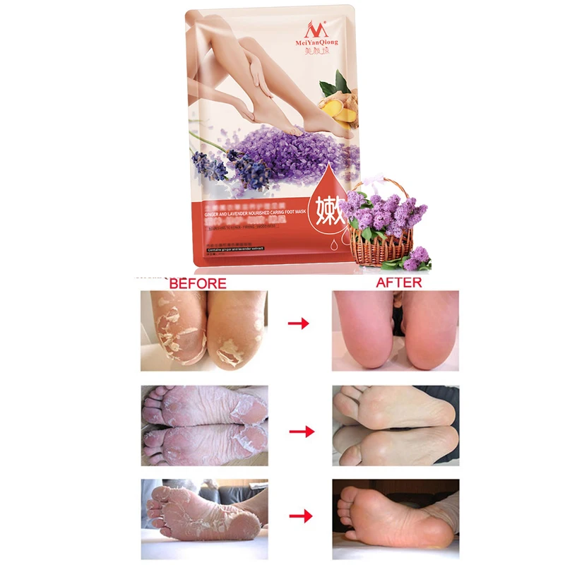 

Ginger And Lavender Foot Mask Peeling for Legs Feet Masks Exfoliating Socks Scrub For Pedicure Anti Crack Heel Remove Skin Patch