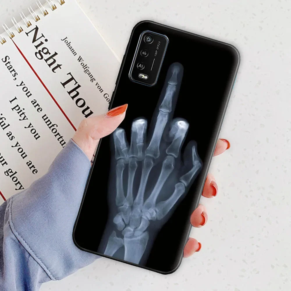 Matte Protective TPU Silicone Soft Back Bumper Case Cover