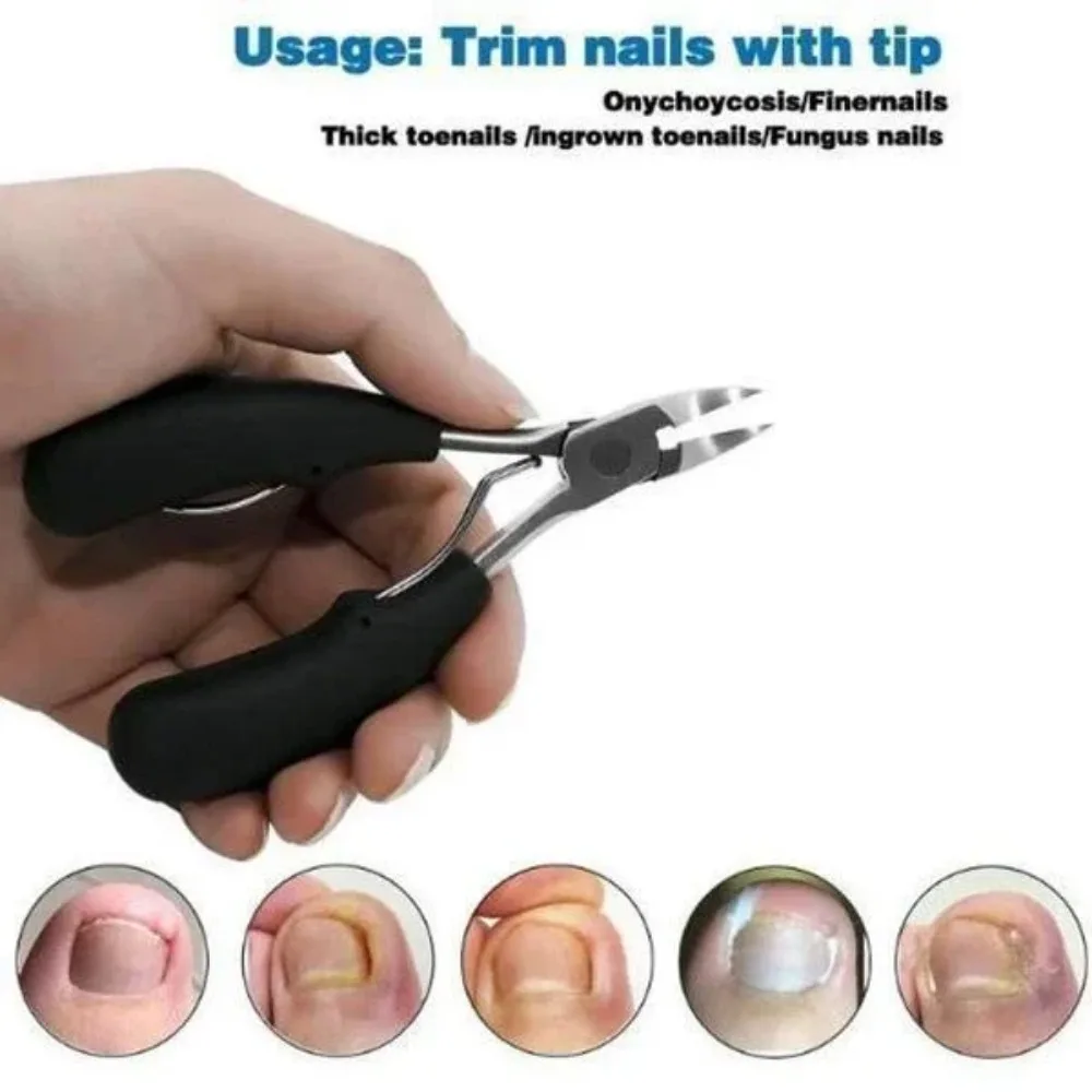 Medical-Grade Nail Clippers Podiatry Nail Clippers Correction Nippers Clipper Cutters Dead Skin Dirt Remover