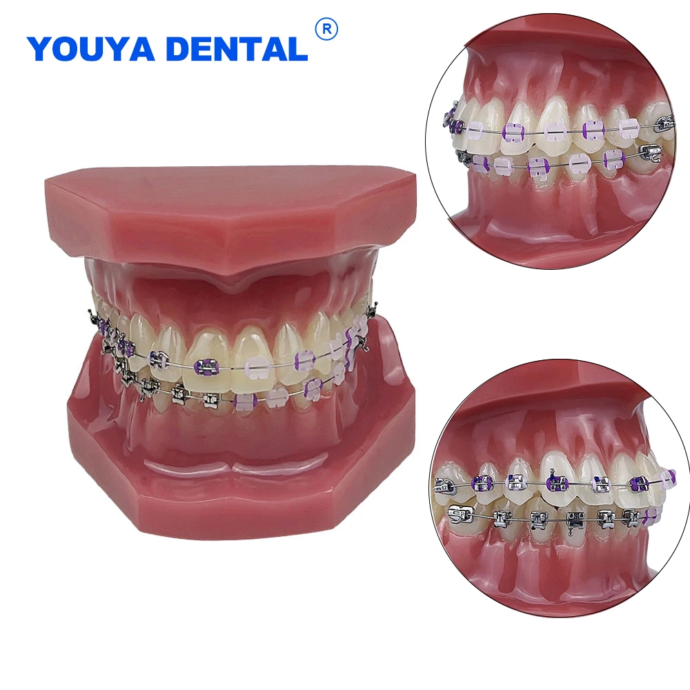 Dental Orthodontic Resin Teeth Model with Metal and Ceramic Brackets