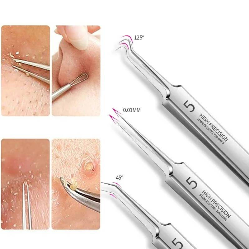 Blackhead Remover Acne Remover