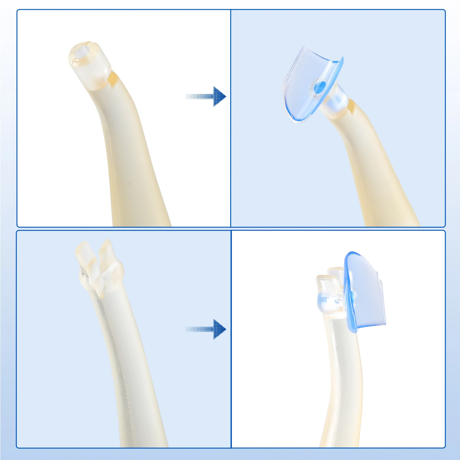 100 Stück/Set AZDENT Dental Matrix Blaues Klares Matrixband-Kit für Komposit-Gingiva-Zahnmedizin-Werkzeuge und -Materialien mit 2 Griffen – Detail 6