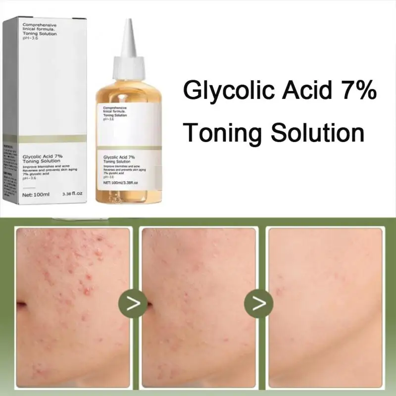 

Glycolic Acid 7% Toning Solution Dispelling acne Acne Remover Lifting Firming Wrinkles Glowing Facial Skin Care Acid Toner New