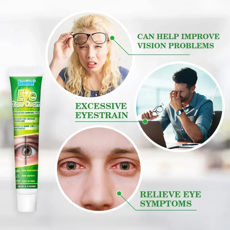 Eye Care Cream Remove Eyes Red Blood Clear Dry Fatigue Ointment Enhance Vision Herbal Medical Plaster Prevent Myopia eye cream