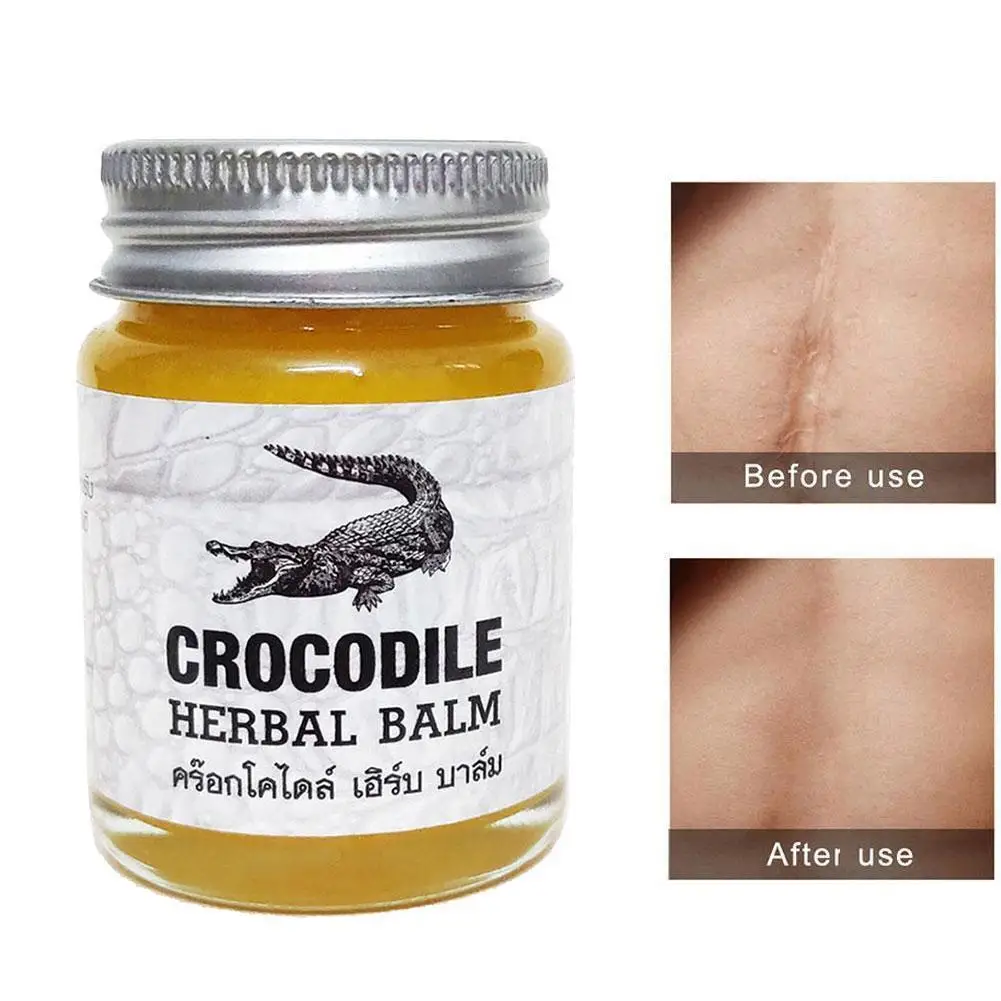 Crocodile Scar Removal Cream Thailand Herbal Balm Whitening Remover Acne Marks Scar Face