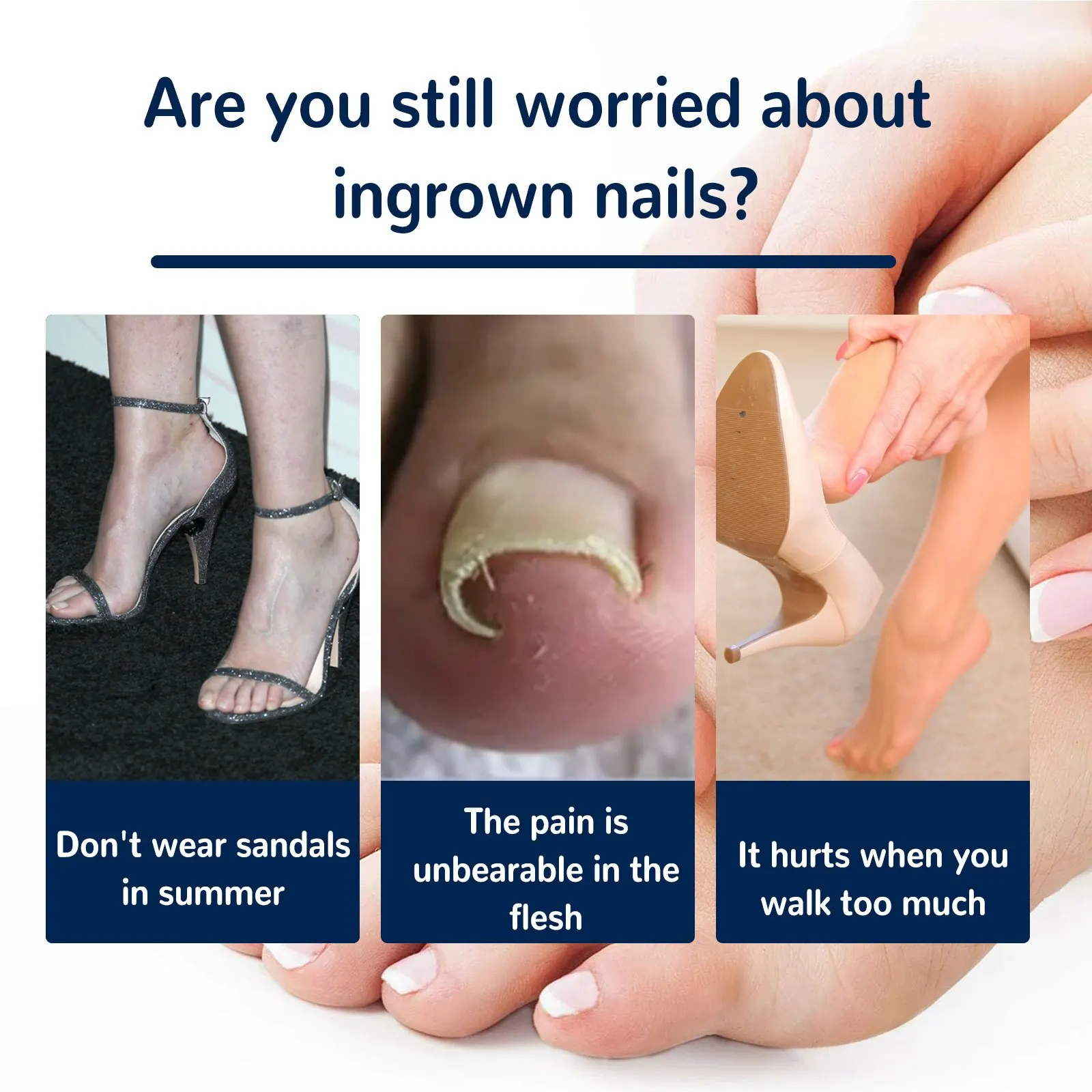Ingrown Toenail Corrector Sticker 100Pcs Foot Care Pedicure Foot Orthodontic Toe Thumb Nail Care Patches,ingrown toenail correction tool,manicure pedicure tool set,foot care tool,foot pedicure tool,foot care patches,toe corrector,nail problem solving
