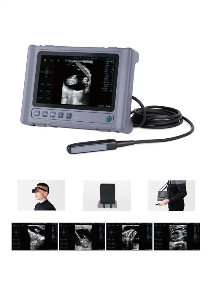 가장 저렴한 휴대용 동물 애완동물 수의학 초음파 소 고품질 휴대용 수의학 초음파 스캐너