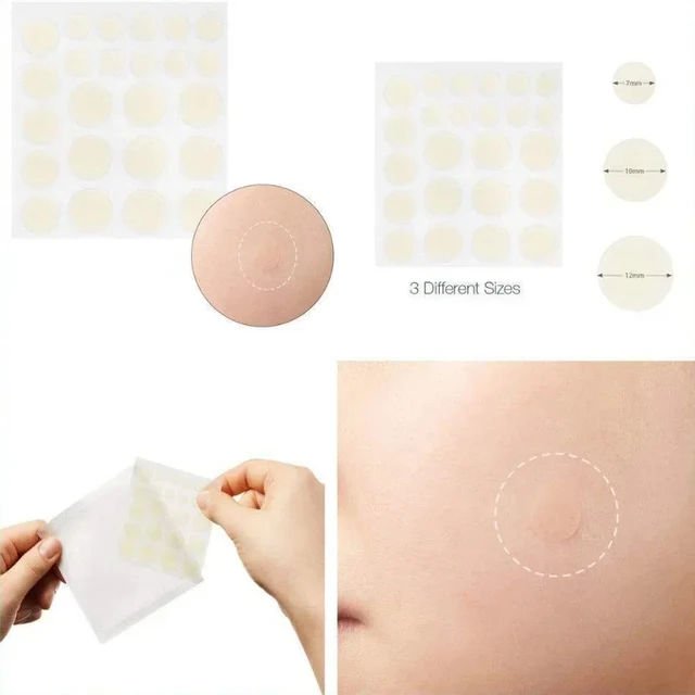 24pcs Face Acne Pimple Spot Facial Skin Care Blackhead Removal Freckle Patches Scar Care Treatment Stickers Acne Mask Beauty 2