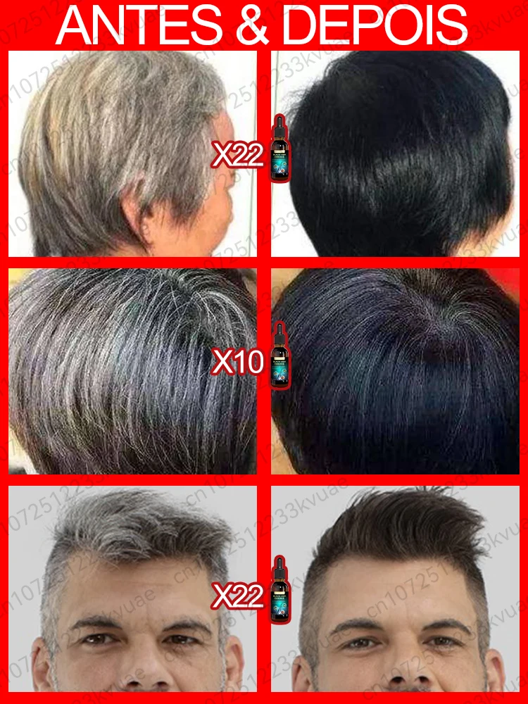 White hair treatment essence quickly turns white hair into black hair, repairs natural color, and prevents gray hair