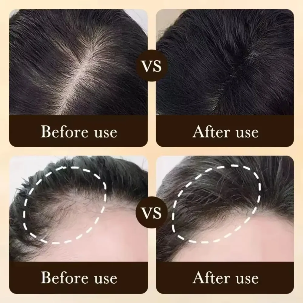 Essenziale per la Crescita dei Capelli, Nutre il Cuoio Capelluto, Migliora la Circolazione, Rafforza i Follicoli Piliferi - immagine 3