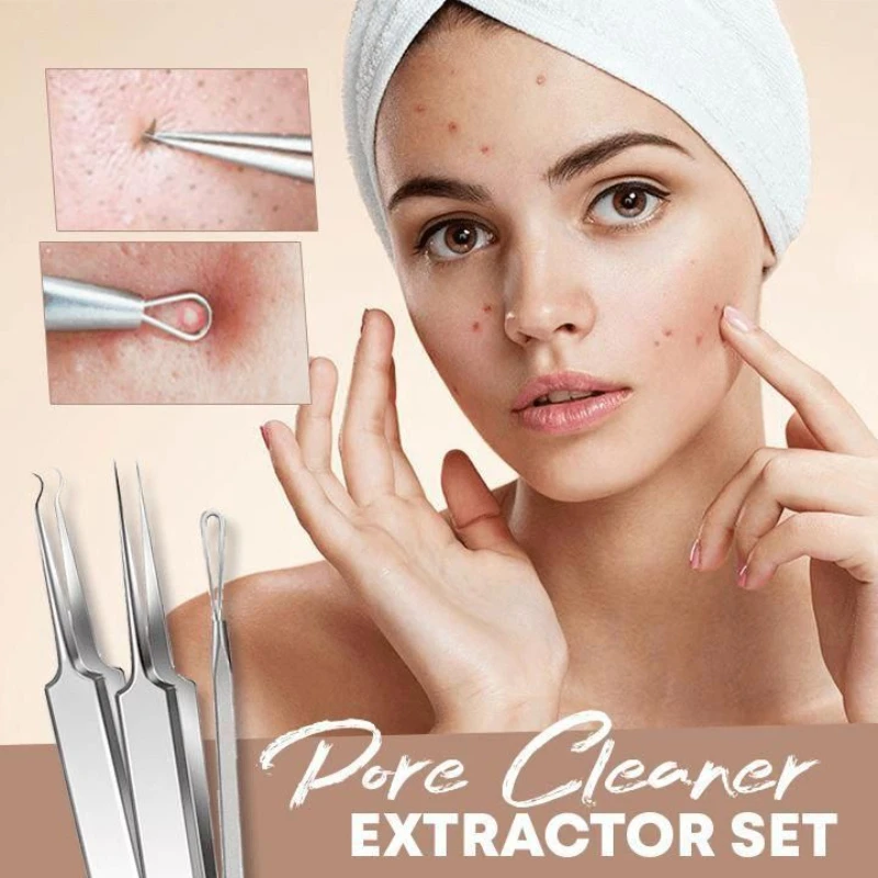 

3/1Pc Ultra-fine Cell Pimples Blackhead Clip Tweezers Beauty Face Skin Care Special Scraping & Closing Artifact Acne Needle Tool