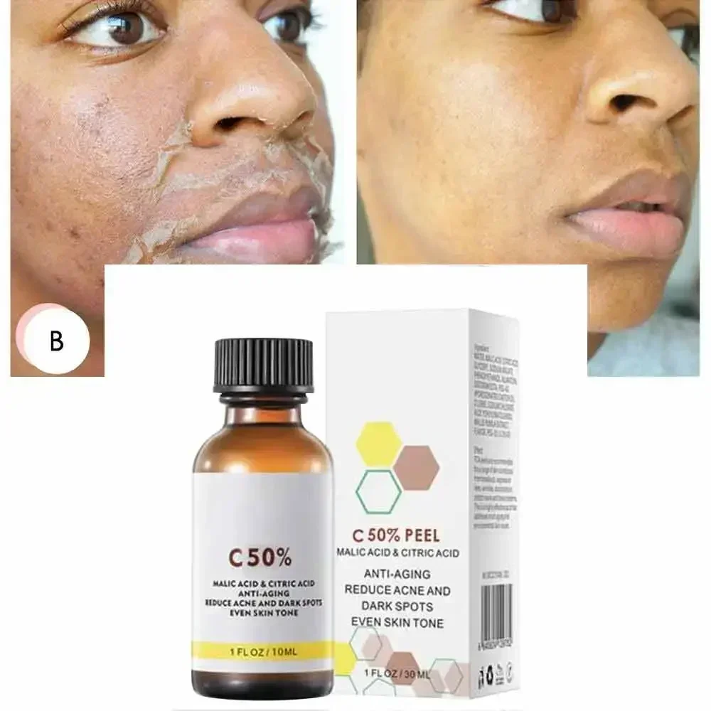 Face Care Exfoliating Peeling Oil Chemical Peel Pigmentation Lightening Melanin Acne Treatment Remove Scar Yellow Peeling Oil