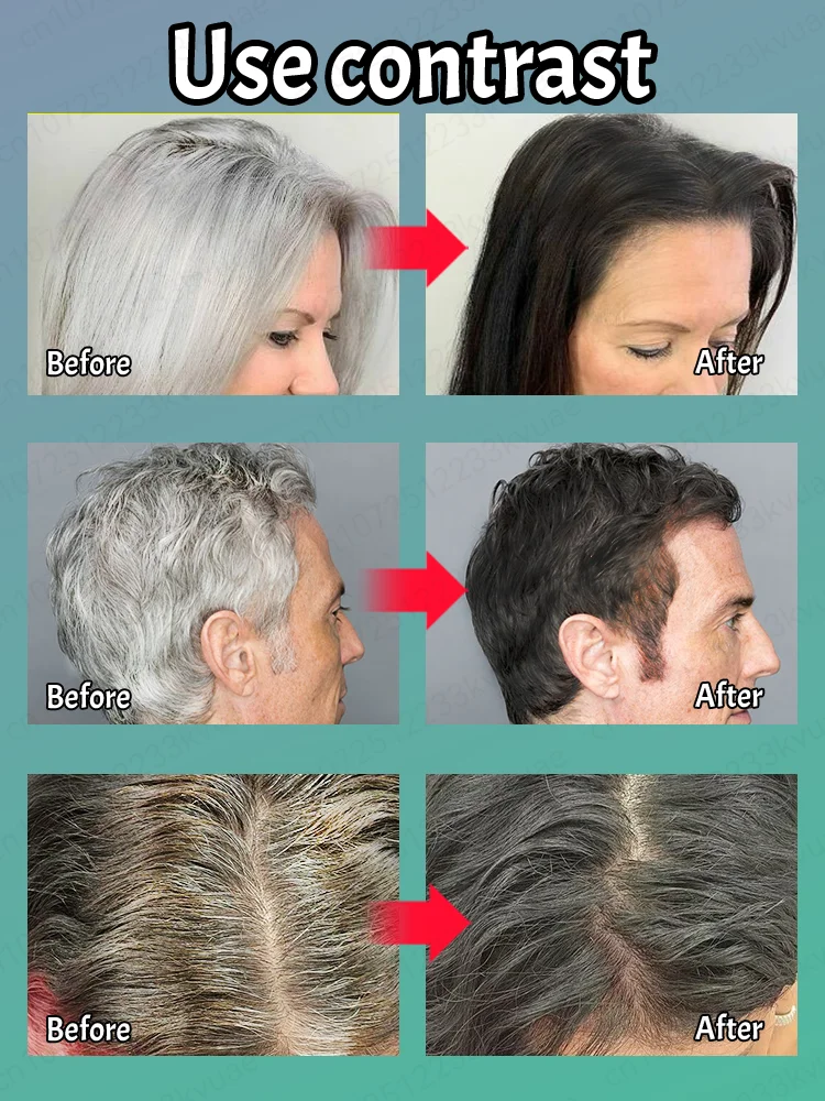 Hair Oil Hair Essence Oil Natural Anti-Gray Hair Serum 7-Day Dark Hair Restoration & 98% Gray Prevention-Root Repair with Botanical Extract