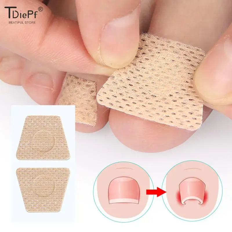 2/6/12Pc Ingrown Toenail Toe Correction Stickers Nail Art Foot Patches Feet Care Paronychia Treatment Recover Pedicure Foot Tool