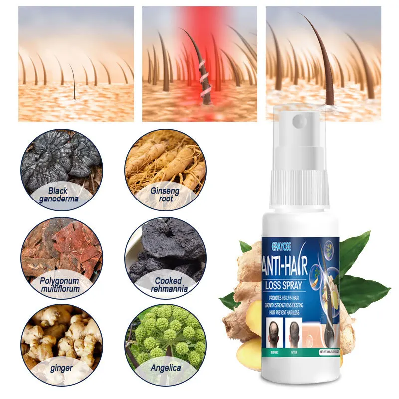 ERAYCEE Ginger Hair Growth Spray Products Natural Anti Hair Loss Serum Prevent Baldness Treatment Fast Grows Nourish Damaged Hai
