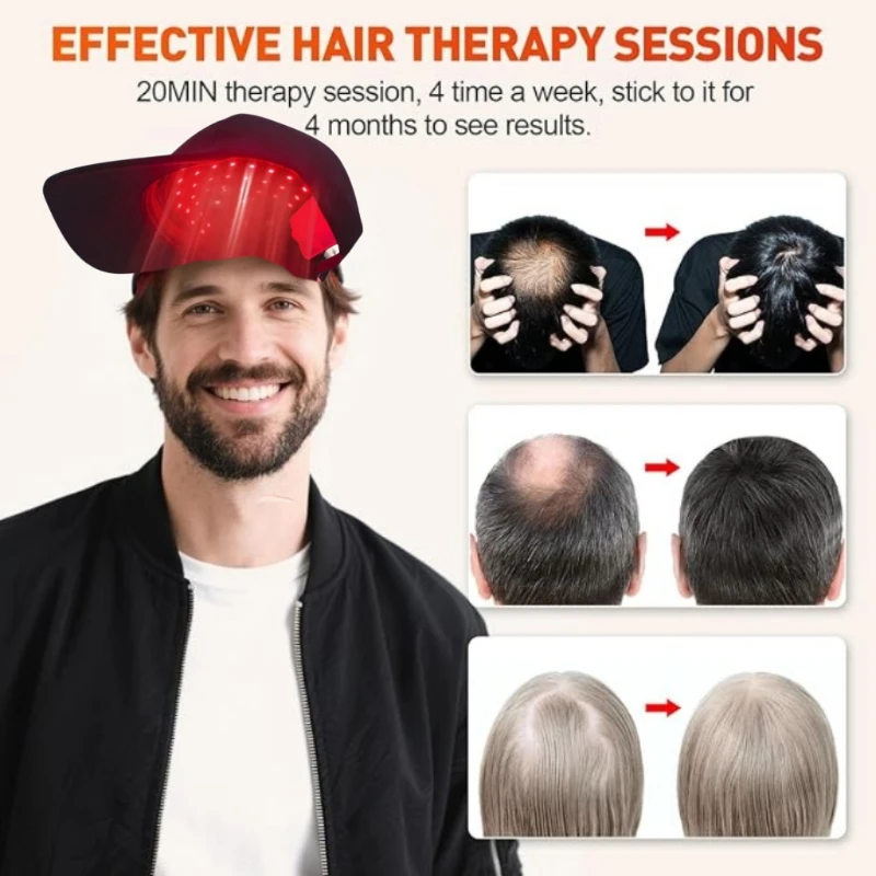 Portable Red Light Therapy Hat for Home Use 100 LED Beads with Timer Function for Hair Care