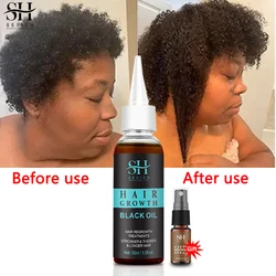 Africa Fast Hair Growth Oil Traction Alopecia Hair Thinning Treatment Essence Black Oils Repairs Damage Anti-Hair Loss Products