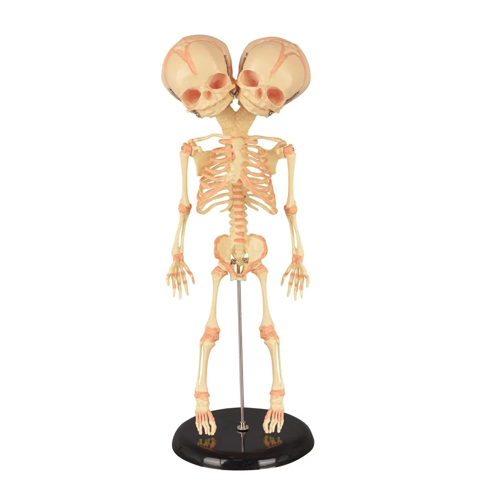 Human Double Head Baby Skull Model Skeleton Anatomy Medical Science Display Study Teaching Model